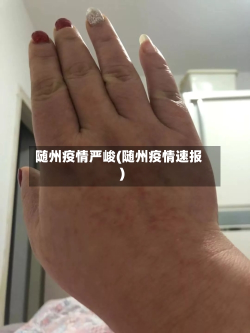 随州疫情严峻(随州疫情速报)-第3张图片