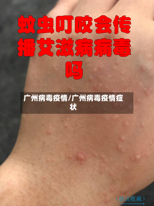 广州病毒疫情/广州病毒疫情症状-第3张图片