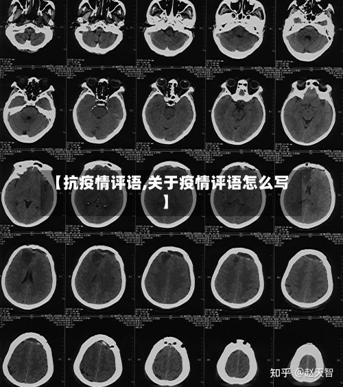 【抗疫情评语,关于疫情评语怎么写】