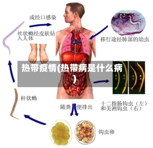 热带疫情(热带病是什么病)-第2张图片