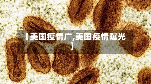 【美国疫情广,美国疫情曝光】-第2张图片