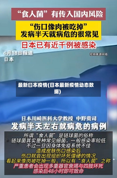 最新曰本疫情(日本最新疫情动态数据)