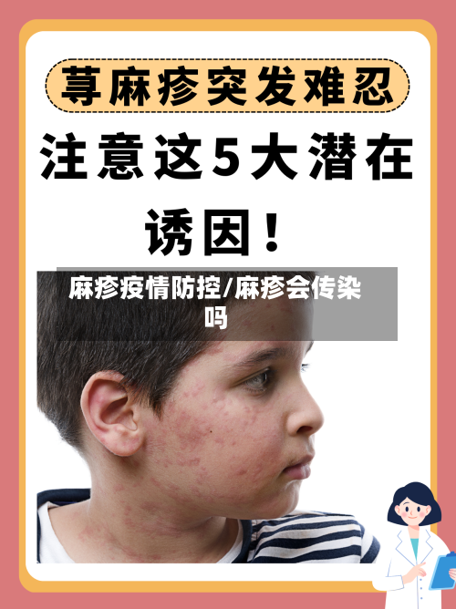 麻疹疫情防控/麻疹会传染吗-第2张图片