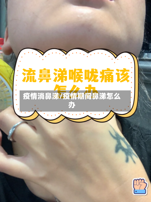疫情淌鼻涕/疫情期间鼻涕怎么办-第2张图片