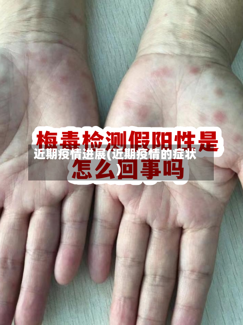 近期疫情进展(近期疫情的症状)