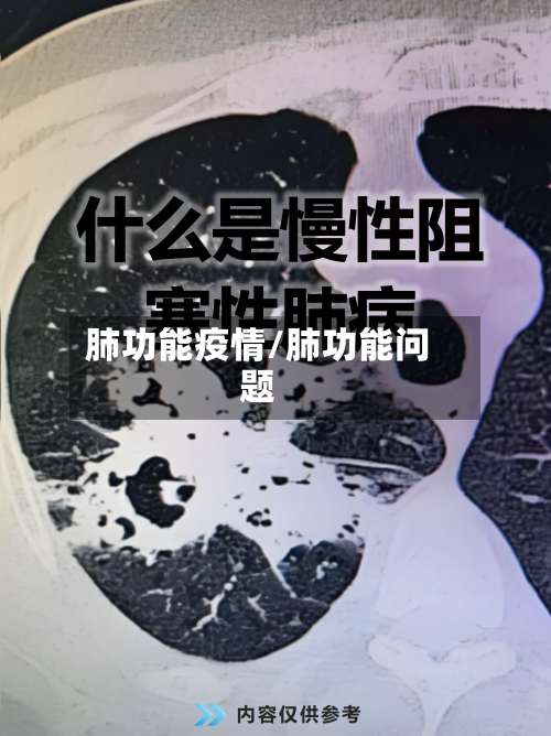 肺功能疫情/肺功能问题