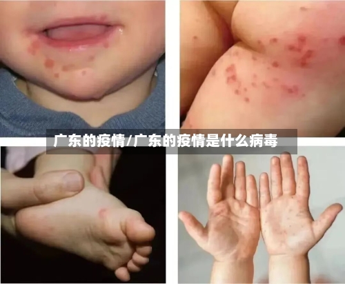 广东的疫情/广东的疫情是什么病毒