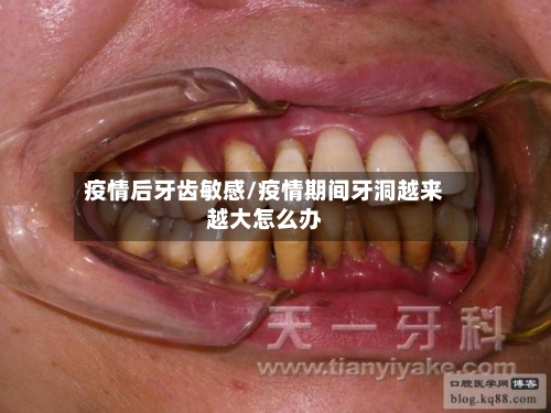 疫情后牙齿敏感/疫情期间牙洞越来越大怎么办