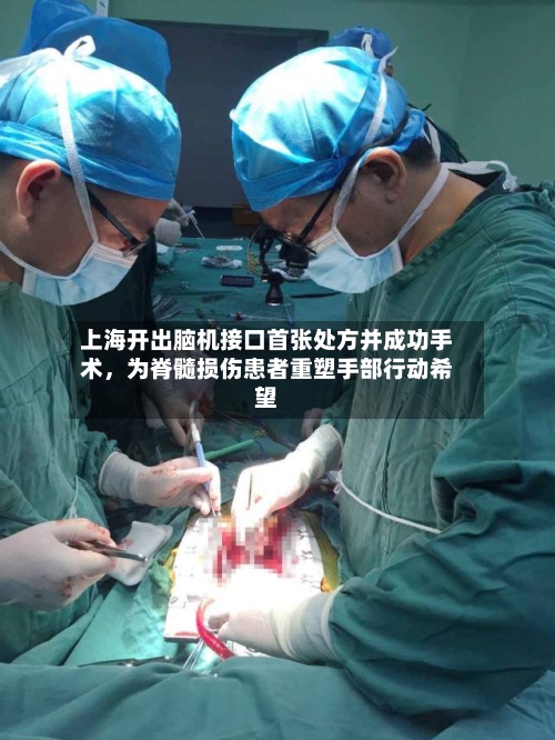 上海开出脑机接口首张处方并成功手术，为脊髓损伤患者重塑手部行动希望-第2张图片