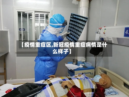 【疫情重症区,新冠疫情重症病情是什么样子】