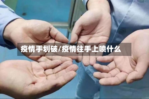 疫情手划破/疫情往手上喷什么-第2张图片