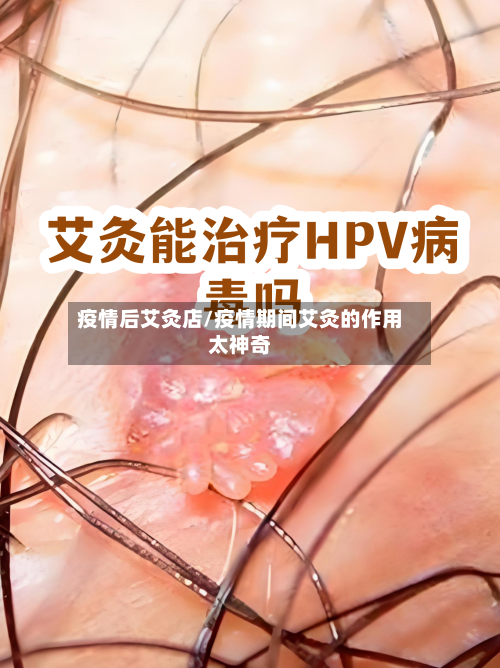 疫情后艾灸店/疫情期间艾灸的作用太神奇