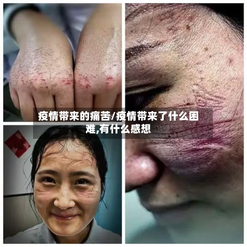 疫情带来的痛苦/疫情带来了什么困难,有什么感想-第3张图片