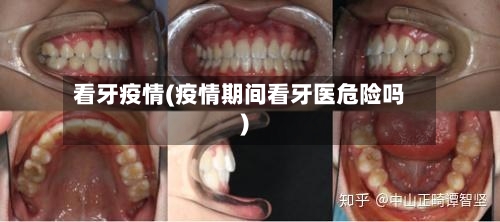 看牙疫情(疫情期间看牙医危险吗)