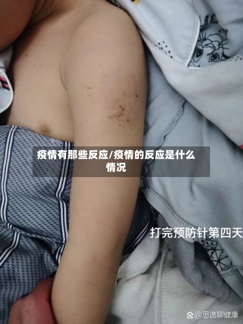 疫情有那些反应/疫情的反应是什么情况