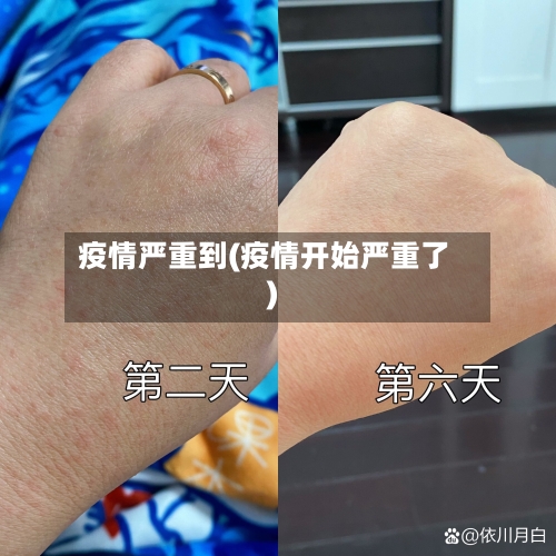 疫情严重到(疫情开始严重了)-第2张图片
