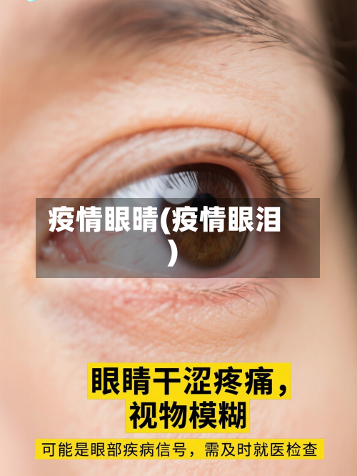 疫情眼晴(疫情眼泪)-第2张图片