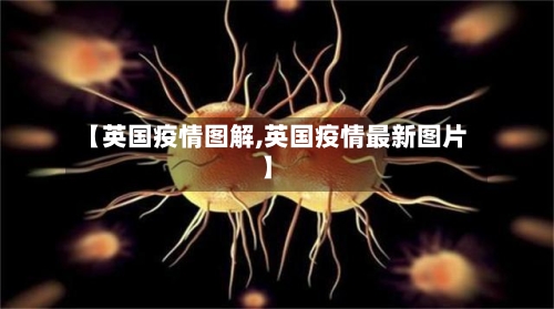 【英国疫情图解,英国疫情最新图片】-第2张图片