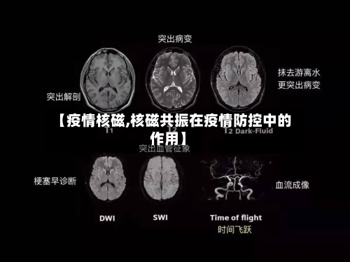 【疫情核磁,核磁共振在疫情防控中的作用】-第2张图片