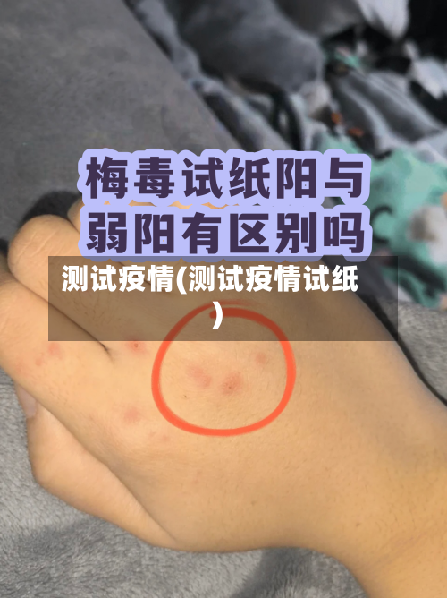 测试疫情(测试疫情试纸)
