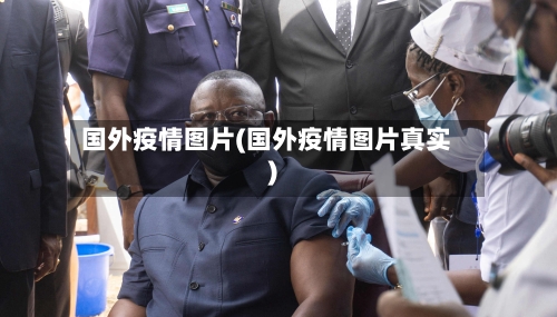 国外疫情图片(国外疫情图片真实)