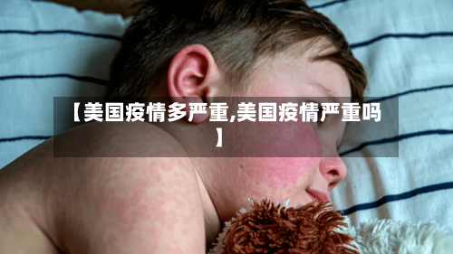 【美国疫情多严重,美国疫情严重吗】
