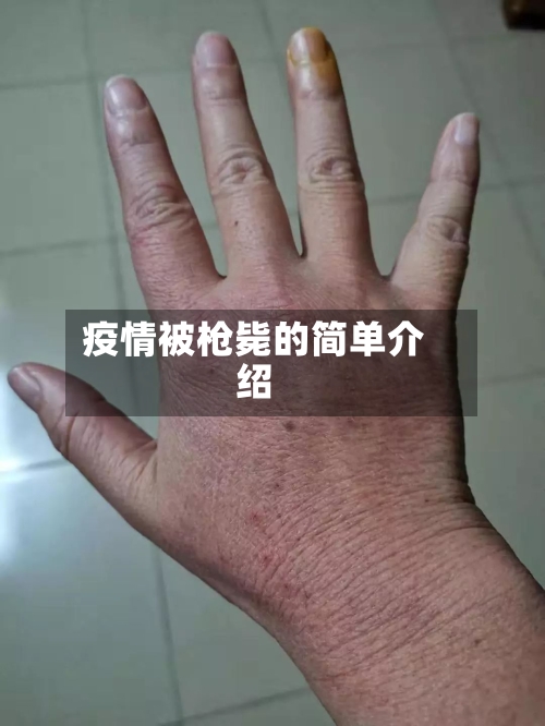 疫情被枪毙的简单介绍