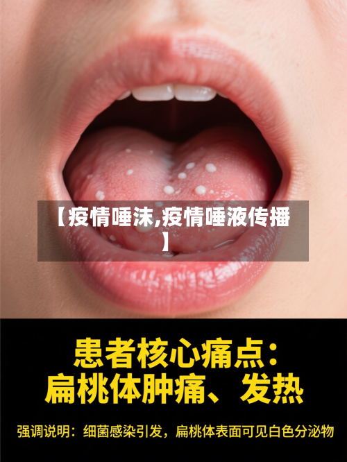 【疫情唾沫,疫情唾液传播】-第2张图片