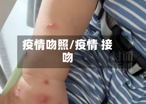疫情吻照/疫情 接吻-第3张图片