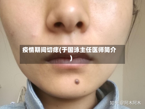 疫情期间切痣(于国泳主任医师简介)-第2张图片