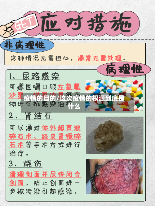 疫情的目的/这次疫情的根源到底是什么-第3张图片