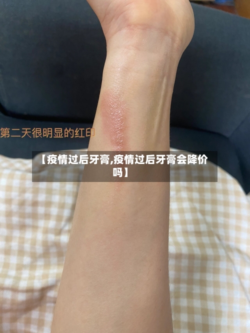 【疫情过后牙膏,疫情过后牙膏会降价吗】