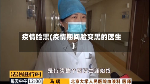 疫情脸黑(疫情期间脸变黑的医生)-第3张图片