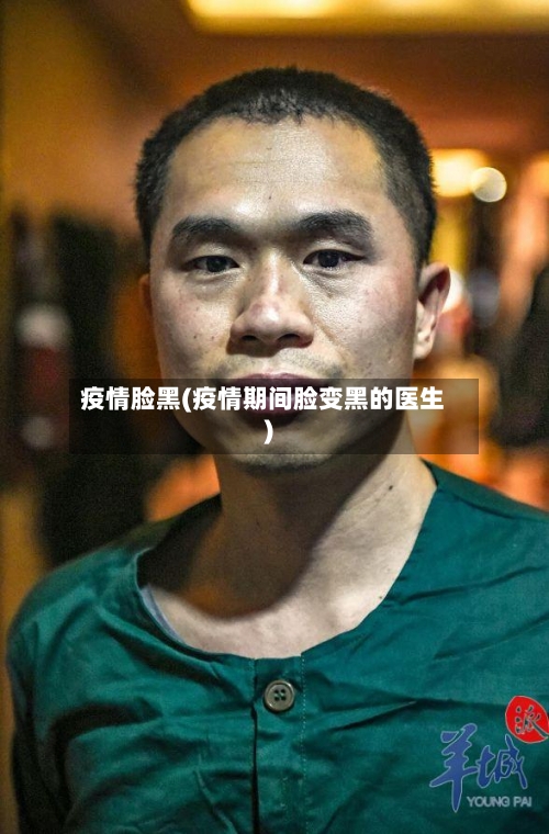 疫情脸黑(疫情期间脸变黑的医生)-第2张图片
